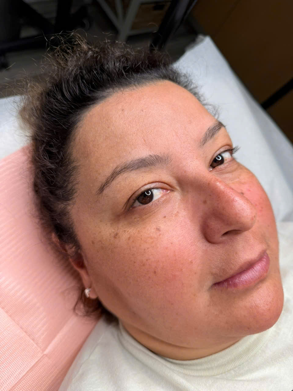 Glowing skin after microneedling Lumberton TX at Fairy Lashes & Brows